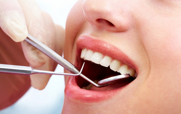 Teeth Cleaning