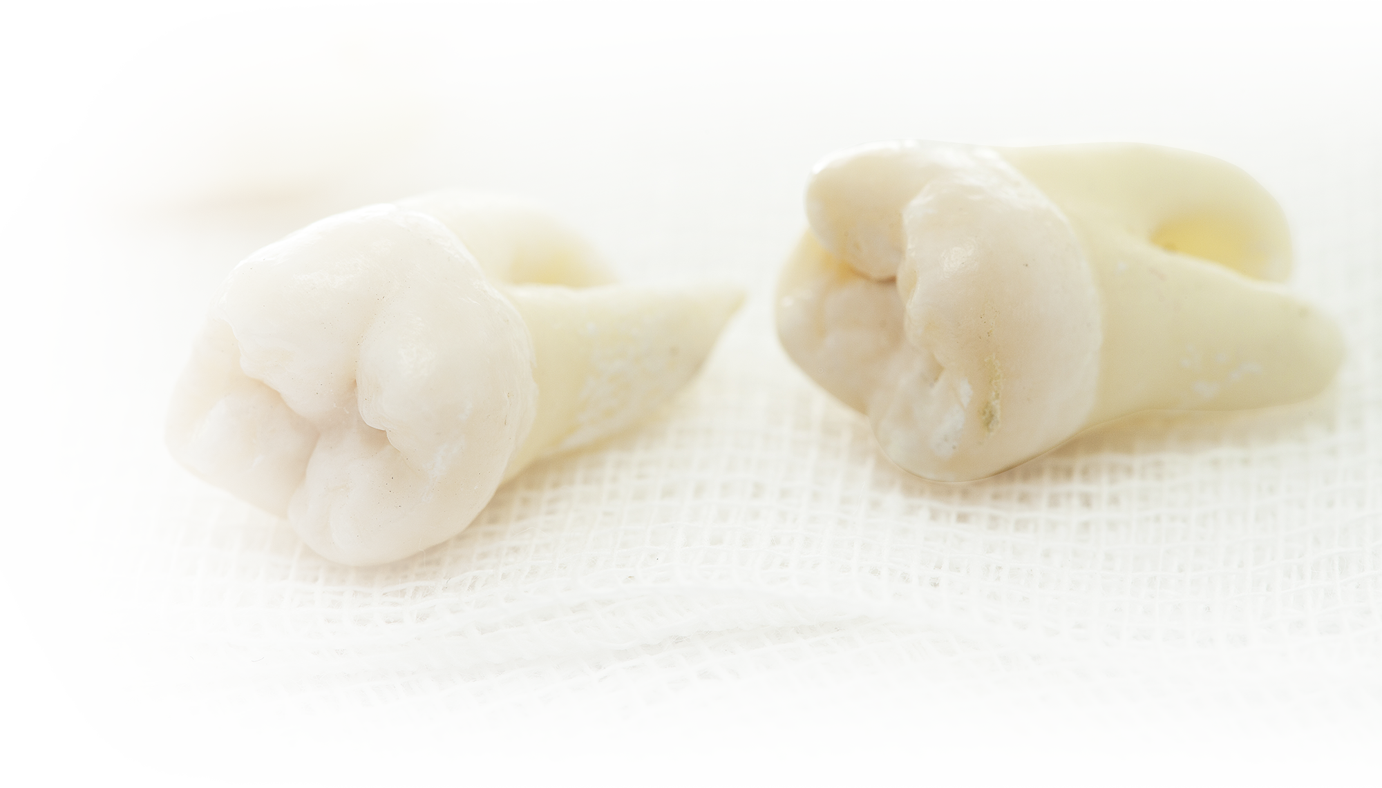 wt-bg2 wisdom tooth image