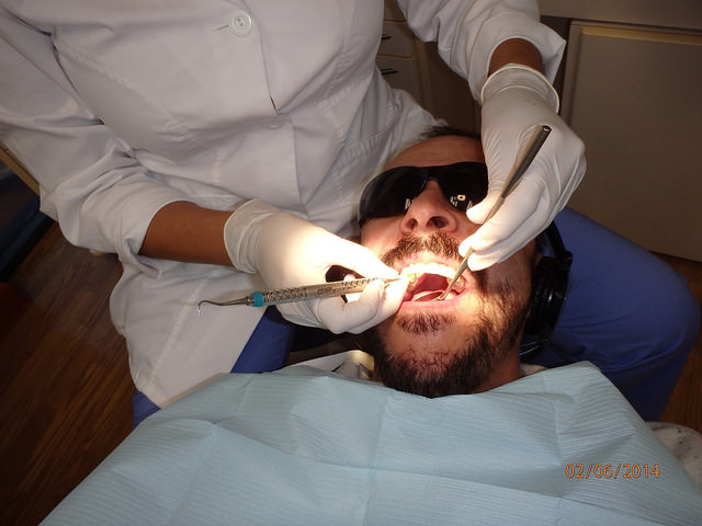 dental cleaning - deep cleaning