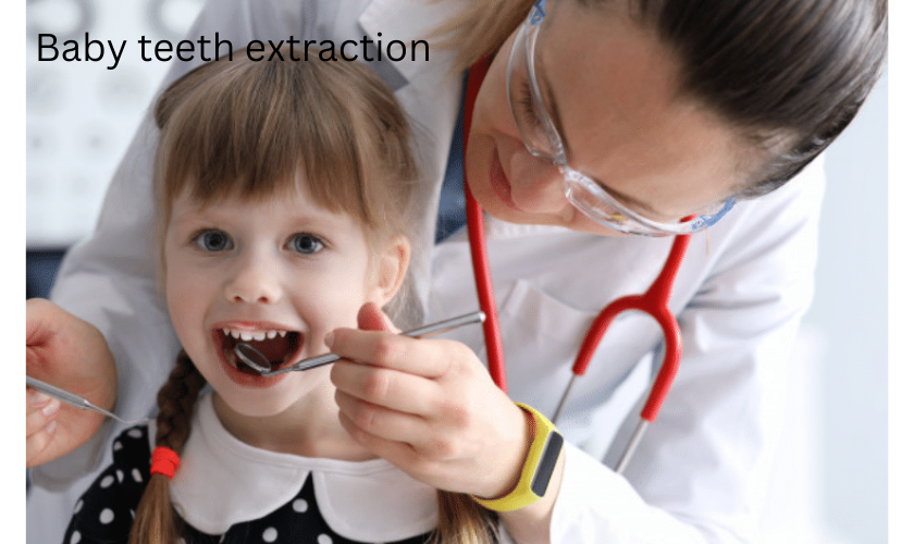 baby teeth extraction