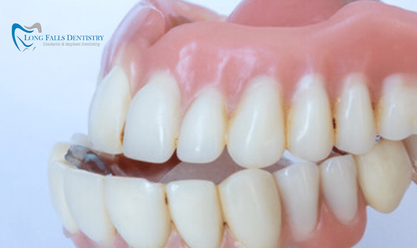 Steps to Remove Plaque from Dentures