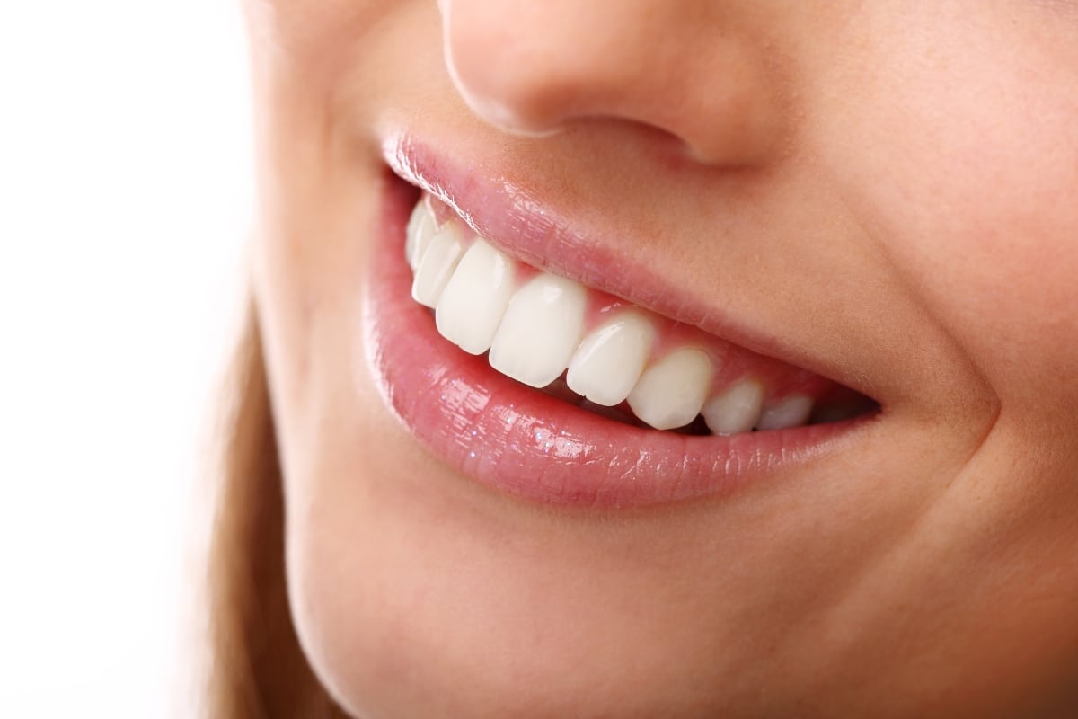 Teeth-Whitening-in-Carthage