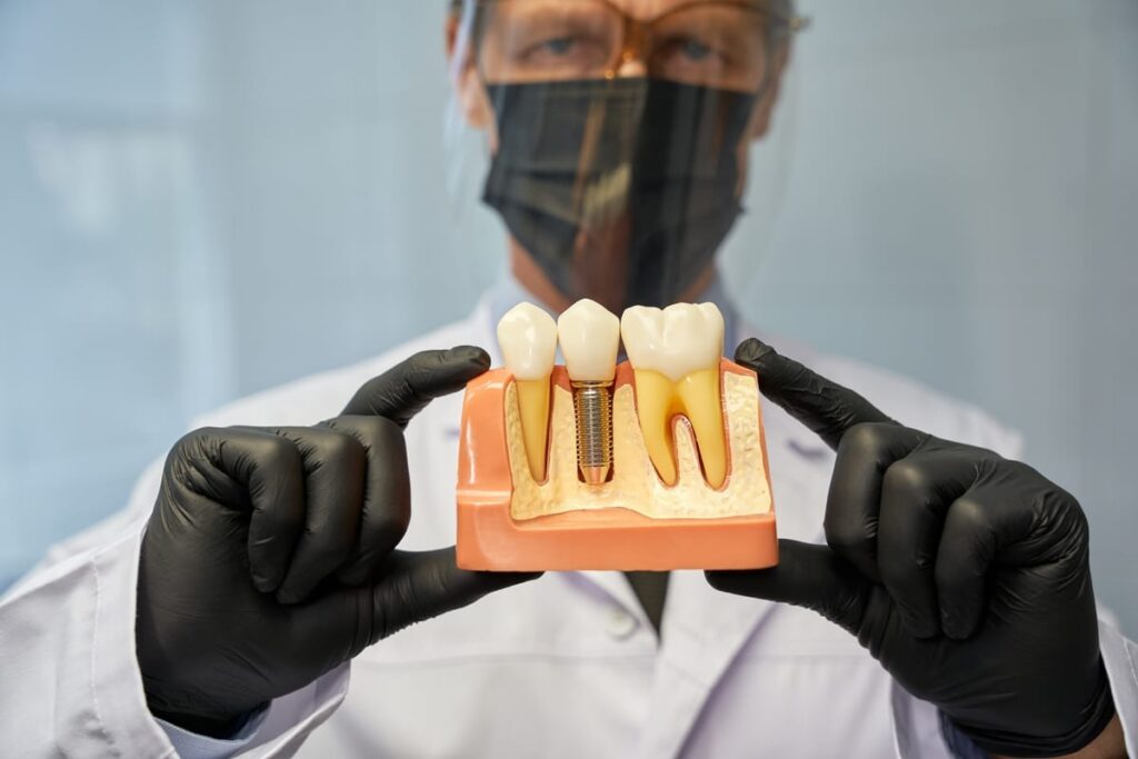 Dental Implants in Carthage