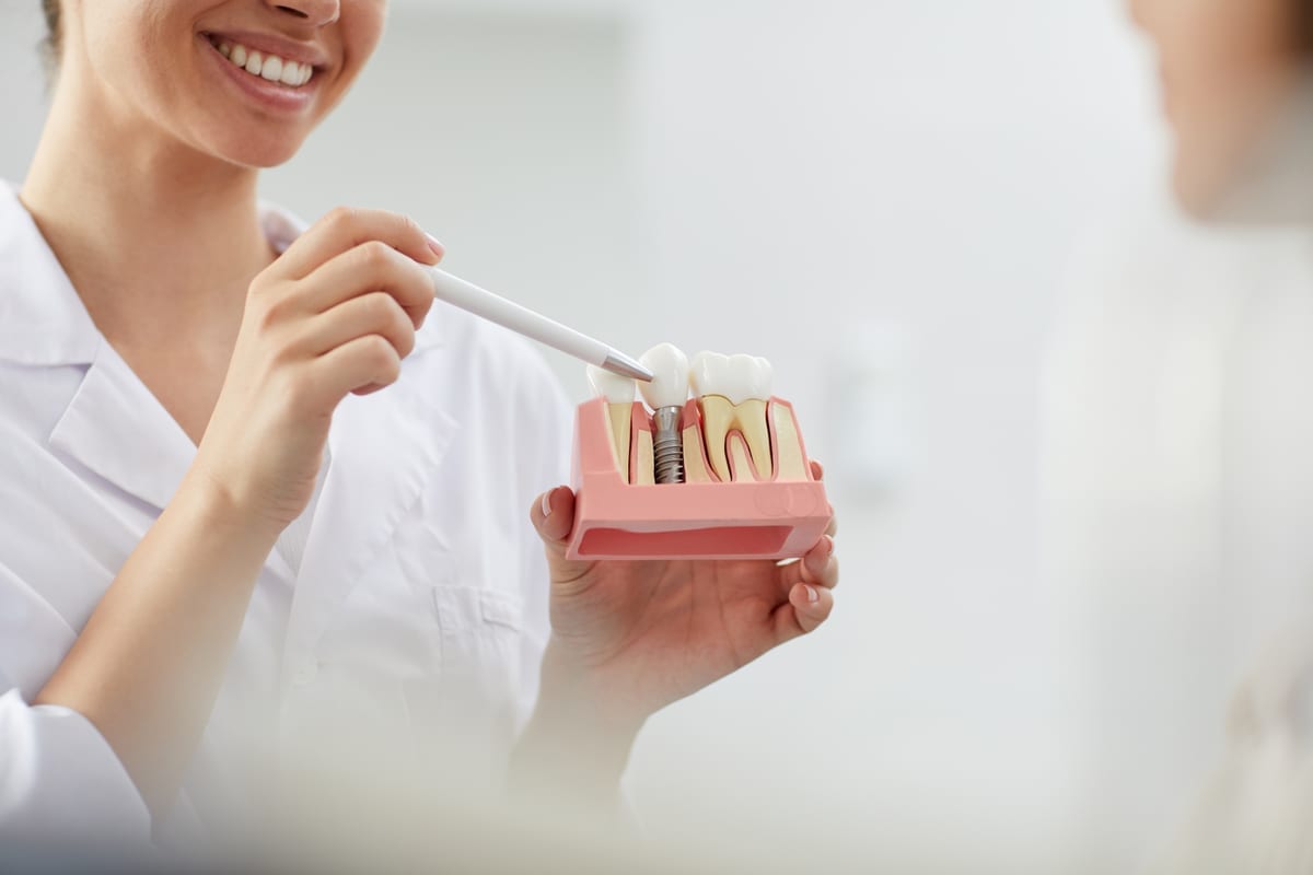 Dental Implants in Carthage